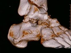 CU CT scan of ankle / Vermont, USA Stock Footage