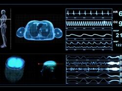Medical Scanner MRI XRay Monitor Display Stock Footage