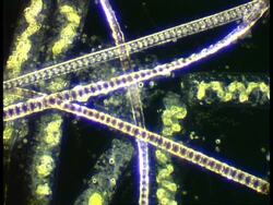Dark Field image of strands of filamentous algae Stock Footage
