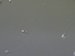 Two Human sperm swimming, Interference contrast Stock Footage