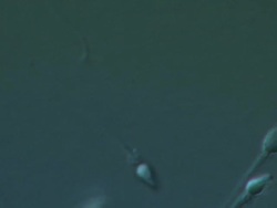 Single Human sperm swimming, big close up, Interference contrast Stock Footage