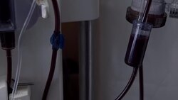 Working artificial kidney Stock Footage