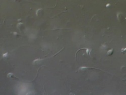 Human sperm swimming, masses, Interference contrast Stock Footage