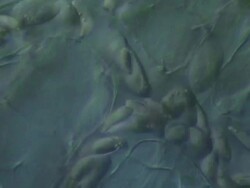 Capillaries of Toad tadpole tail.  Olympus BH-2 microscope Olympus S-Plan 20x objective with 5x photoeyepiece. Differential Interference Contrast. Shutter speed 1/1000 second. Horizontal field of view 340 micrometres. Stock Footage