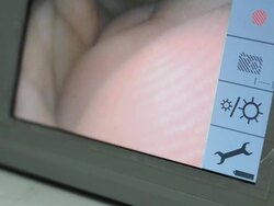 Laryngoscope  Monitor Stock Footage