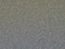 Bacteria filling frame Stock Footage