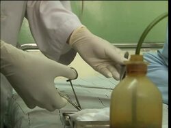 Man claims Taliban cut off nose and ears for voting News Clip