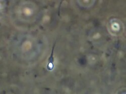 Single Human sperm swimming, close up, Phase contrast Stock Footage