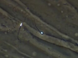 Human sperm, single sperm swimming but not getting very far Stock Footage