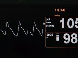 Vital signs monitor Stock Footage