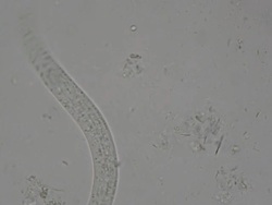 Parasite : Strongeroides stercolaris Stock Footage