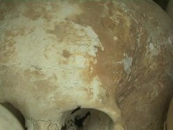 Pull Back Shot Skull In Killing Fields Phnom Penh Cambodia  Stock Footage