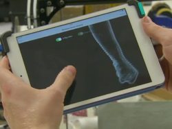 Generic shots of 3D printing, 3D scan, prosthetic hand News Clip