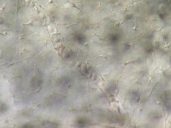 Blood cells moving through capillaries of tail of tadpole of Toad Bufo bufo Stock Footage