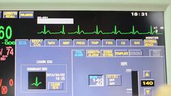 Vital signs monitor Stock Footage
