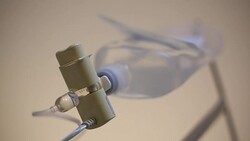 Infusion bottle with IV solution to help patient Stock Footage