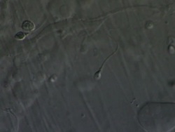 Single Human sperm swimming against the flow of semenal plasma, Interference contrast Stock Footage