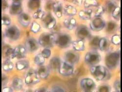 Exflagellation caused by Plasmodium berghei, the malarial parasite, in mouse blood cells Stock Footage