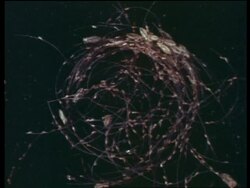 Experiments in laboratory, microscopic shots of lice and eggs on human hair, United Kingdom Stock Footage