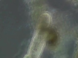 Planarian worm Stock Footage