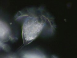 Dark Field view of Vorticella filter feeding on bacteria. Stock Footage