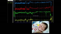 Peter van Manen: Better baby care -- thanks to Formula 1 Instructional Video