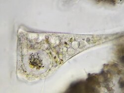 Microorganism - Stentor Stock Footage