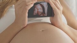 Pregnant woman showing ultrasound image on smart phone Stock Footage