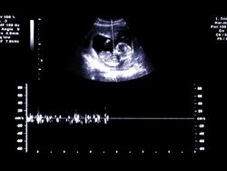 Ultrasound Stock Footage