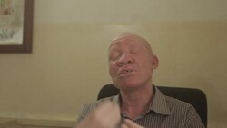 VOICED : Potions and polls: Tanzanian albinos terrified after attacks News Clip