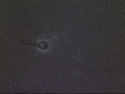 Microscopic Footage of Swimming Sperm Stock Footage