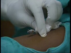 KENYA:NAIROBI: CAMPAIGN ON DANGERS OF ILLEGAL ABORTIONS News Clip