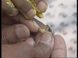 India - Natural Cure For Asthma Sufferers News Clip