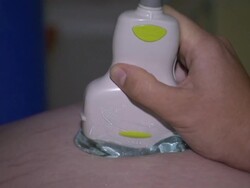 Ultrasound Scan Showing On Computer Screen News Clip