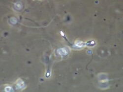 Single Human sperm swimming, Phase contrast Stock Footage