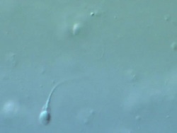 Single Human sperm swimming, best, Interference contrast Stock Footage