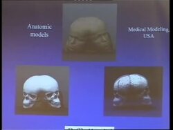 Doctors plan historic surgery for Iranian twins News Clip