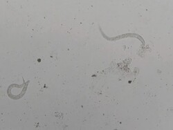 Parasite : Strongeroides stercolaris Stock Footage