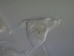 Vorticella sp. filter feeding: inverted bell-shaped ciliates, placed among the peritrichs. Each cell has a separate stalk anchored onto the substrate, which contains a contractile fibril called a myoneme. Stock Footage