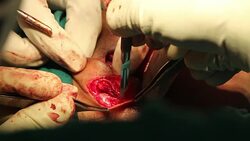 Face Joint dental option Stock Footage