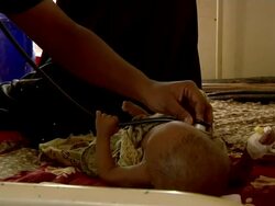 Doctor listens to baby's chest Stock Footage