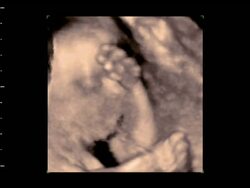 Foetus head and arms in profile, 4D ultrasound scan.. Stock Footage
