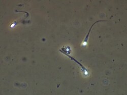 Single Human sperm swimming, Phase contrast Stock Footage