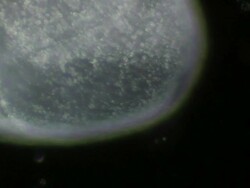 Spirostomum Stock Footage