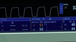 surgery operation Stock Footage