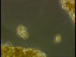 Ciliate protozoan turning rapidly in circles Stock Footage