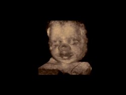 Foetus head up close, rotating 3D ultrasound.. Stock Footage