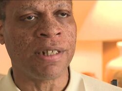 More mentally ill people are being put in nursing homes nationwide alongside older patients, sometimes with tragic results. In Chicago, a 77-year-old man with Alzheimer's was fatally beaten, allegedly by his mentally-ill roommate. News Clip