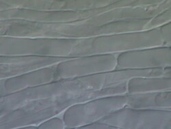 Dry rot fungus (Serpula lacrymans) hyphae, UK Stock Footage