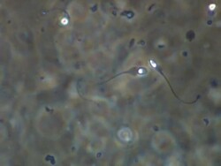 Human sperm swimming, Phase contrast Stock Footage